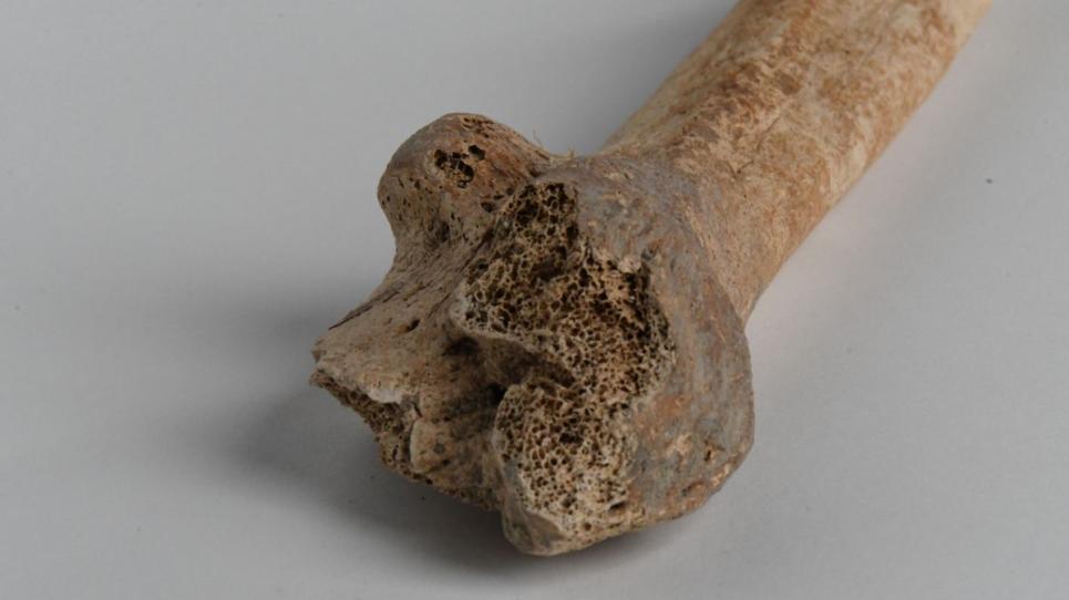 Imatge del projecte "Phygical human bone"